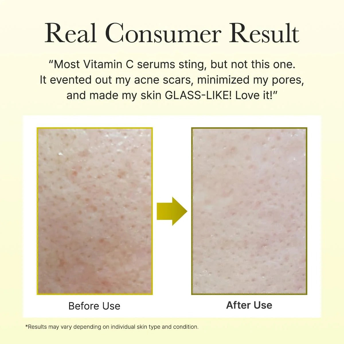 Arencia Vitamin C Booster Shot Serum 30ml | Lightweight Facial Serum for Daily Skincare Routine